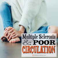 MS and Poor Circulation