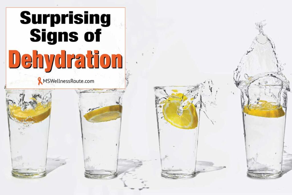Four glasses of water with lemons with overlay: Surprising Signs of Dehydration